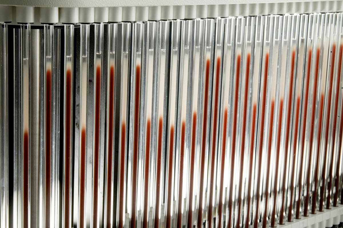 Ständer mit Glasröhrchen, deren untere Hälfte mit roter Lösung gefüllt ist