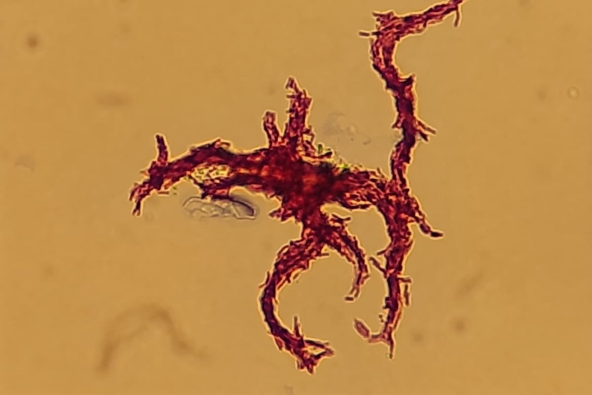 Mikroskopische Aufnahme einer verzweigten, rot gefärbten Struktur